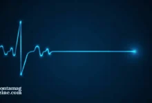 ما الأمراض لا يمكن كشفها عند تخطيط القلب كهربائياً؟