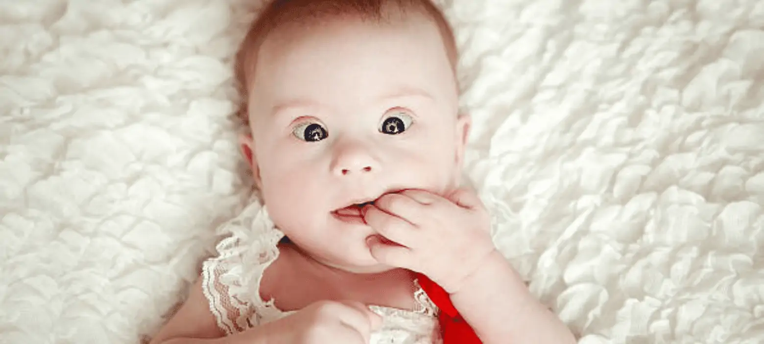 الكشف عن متلازمة داون قبل وبعد الولادة