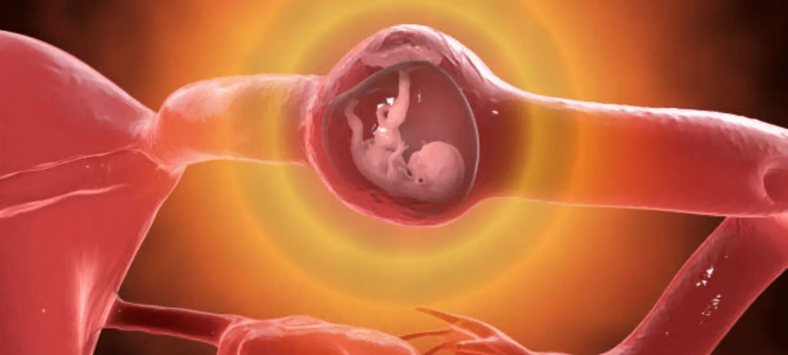 الحمل المنتبذ أو الحمل خارج الرحم