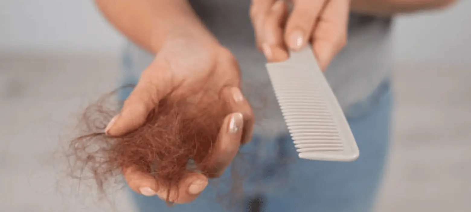 كيفية معالجة تساقط الشعر طبيعيًا