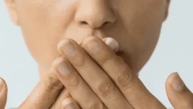 علاج التهاب الجلد حول الفم بالأعشاب